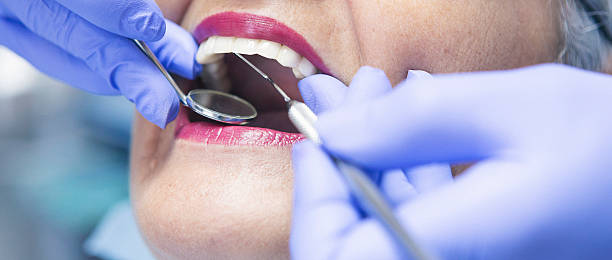 Best Emergency Dentist for Lost Fillings or Crowns in Lovettsville, VA